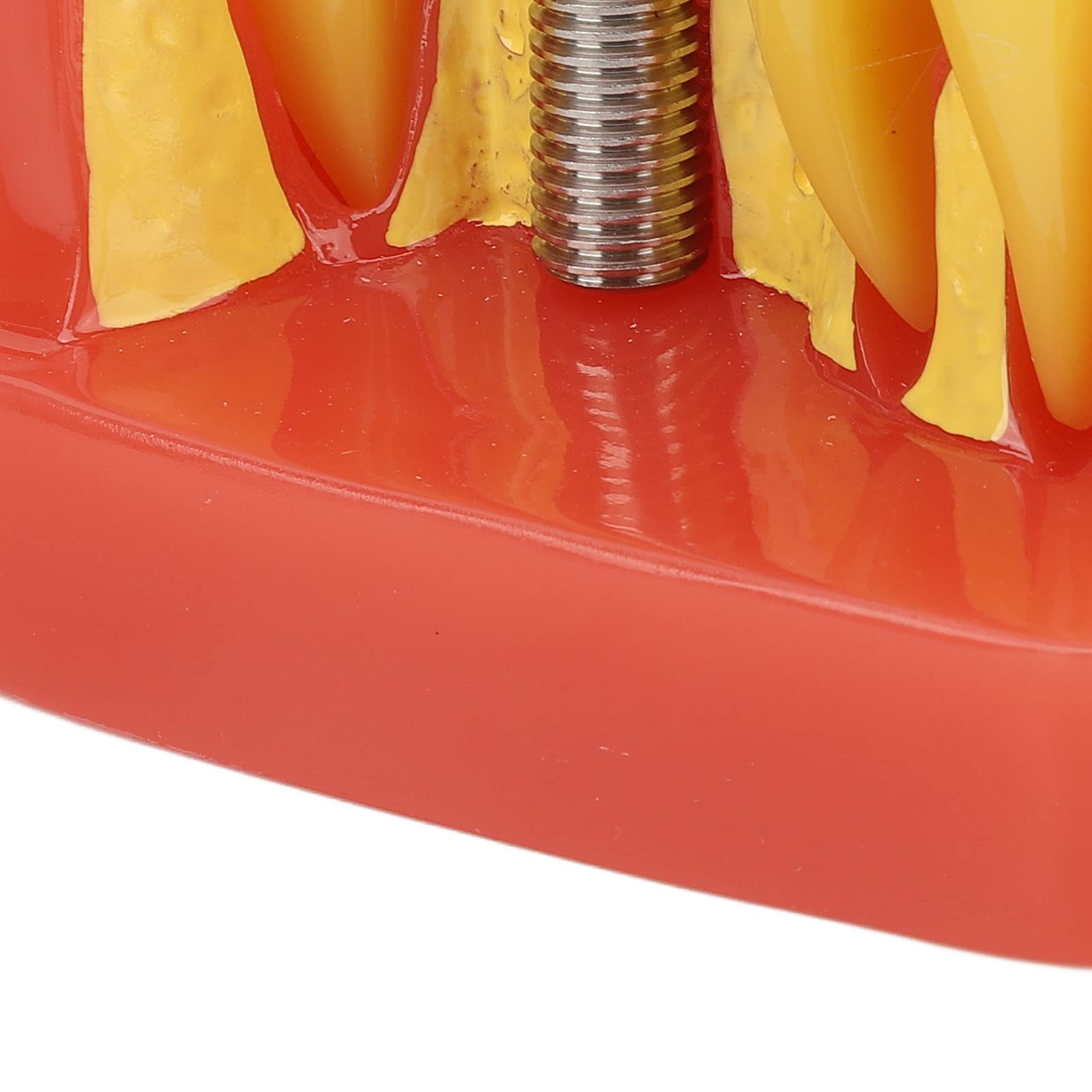Modelo de implante Dental con Corona y Puente extraíbles para demostración y formación