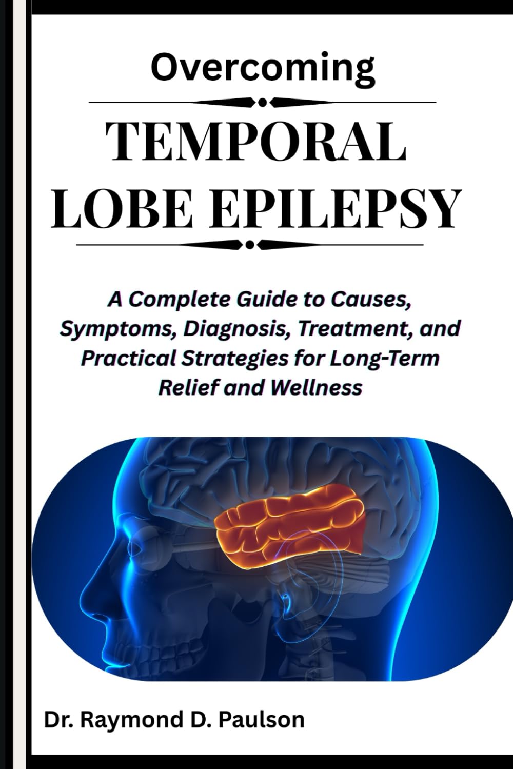 OVERCOMING TEMPORAL LOBE EPILEPSY: A Complete Guide to Causes, Symptoms, Diagnosis, Treatment, and Practical Strategies for Long-Term Relief and Wellness