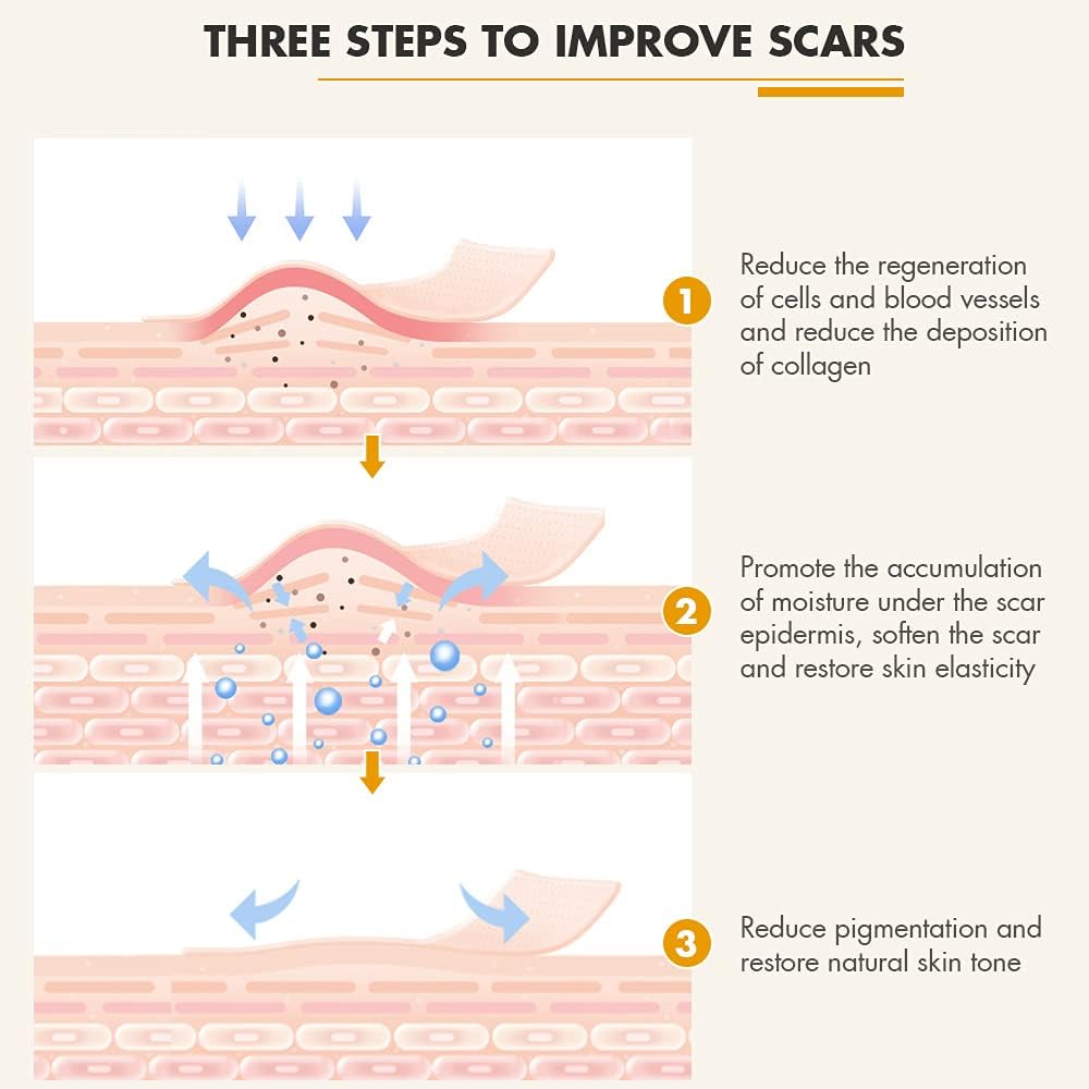 Silicone Scar Strips 1.6" x 6” - 8 Pcs, Reusable Scar Removal Tape for Keloid & Hypertrophic Scars, Medical-Grade Silicone Sheets for Acne, Surgery, Burn Scars, 4-Month Supply - Image 3