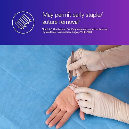 Miniatura 3 de 3M - Tira de cierre de piel Steri-Strip de 12 x 2 pulgadas, tira reforzada de material no tejido, color blanco (#R1549, se vende por caja)