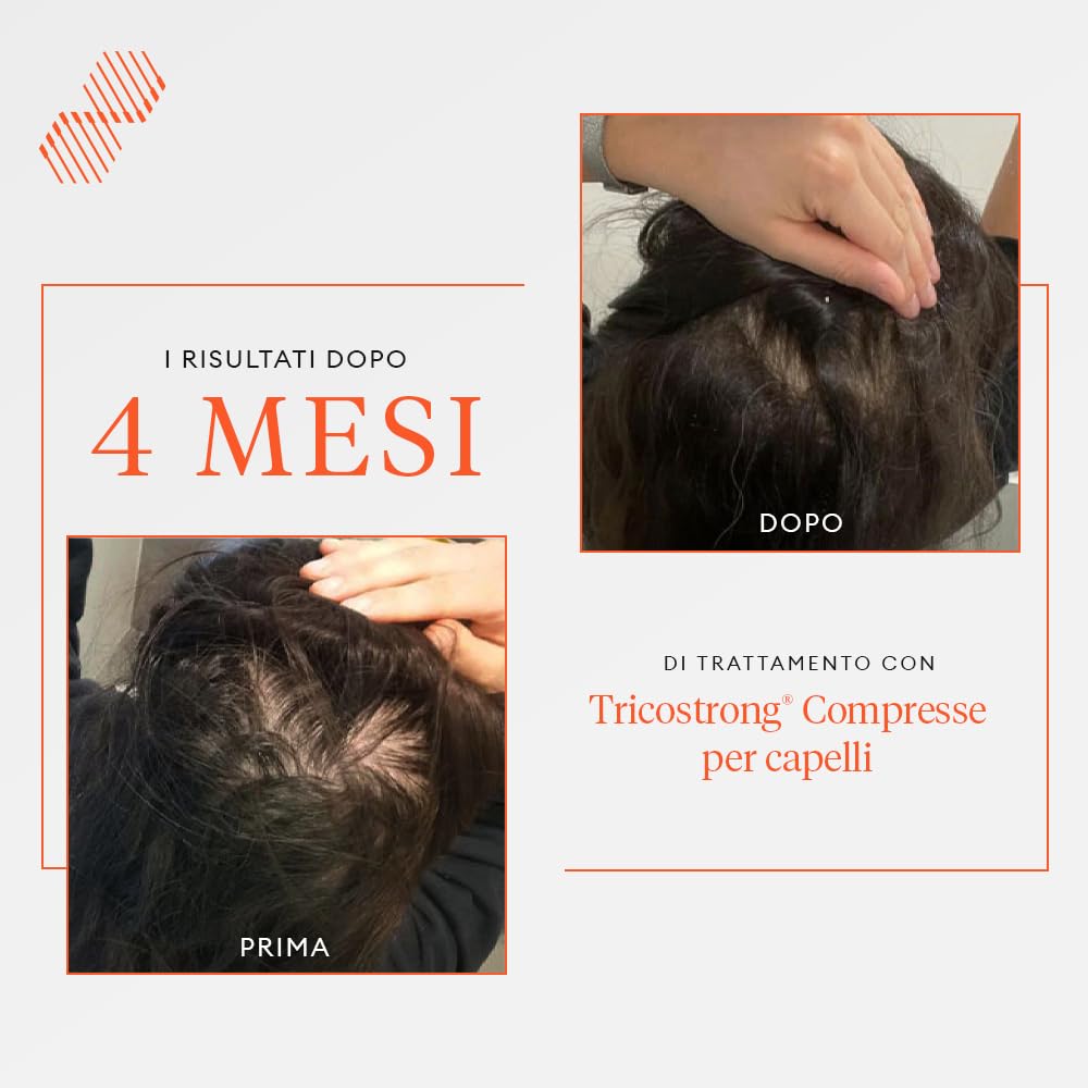 Stanartis Integratore Anticaduta Capelli Nutricum con Tricostrong CPX, Biotina e Zinco – Uomo Donna Crescita e Forza Capelli – 30 Compresse Naturali da 1000 mg