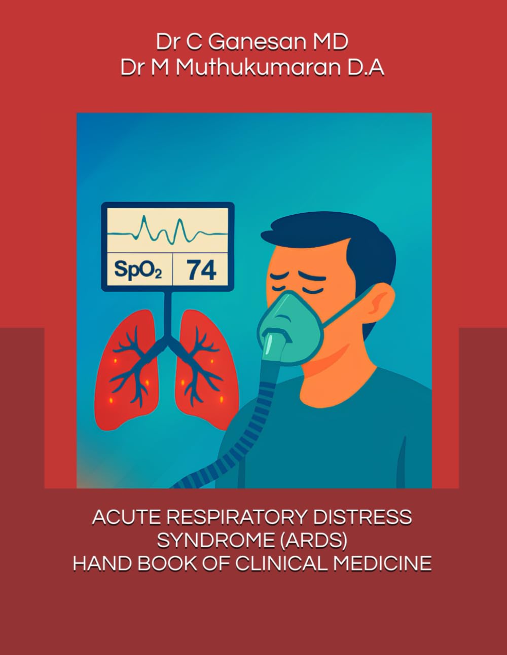 ACUTE RESPIRATORY DISTRESS SYNDROME - HAND BOOK OF CLINICAL MEDICINE