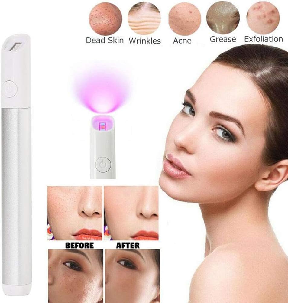 terapia della luce blu per l'acne