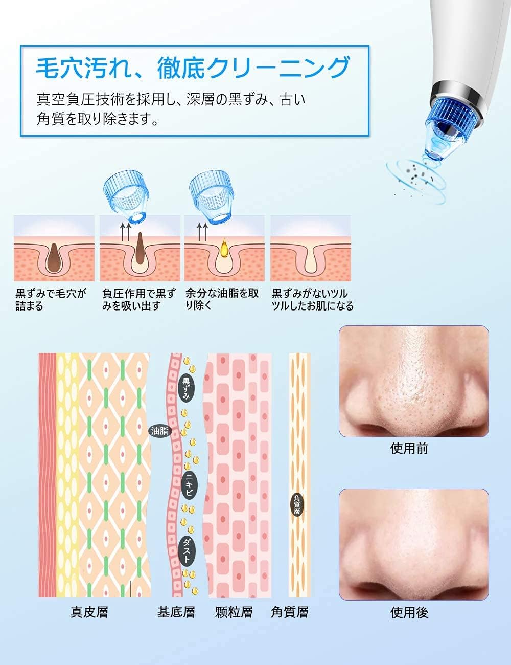 Amazon 毛穴吸引器 毛穴クリーナー 美顔器 温熱ケア キビ吸引 毛穴ケア 黒ずみ吸出し 角栓 汚れ除去 シワ減少 引力調整可能 毛穴クリーン 5種類の吸引ヘッド Usb充電式 毛穴吸引機 男女兼用 Boogiio ビューティー 通販