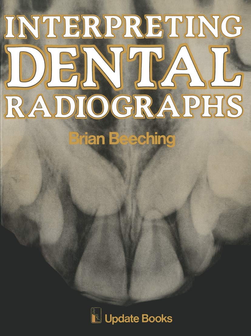 Interpreting Dental Radiographs Amazon.co.uk Beeching, B. W