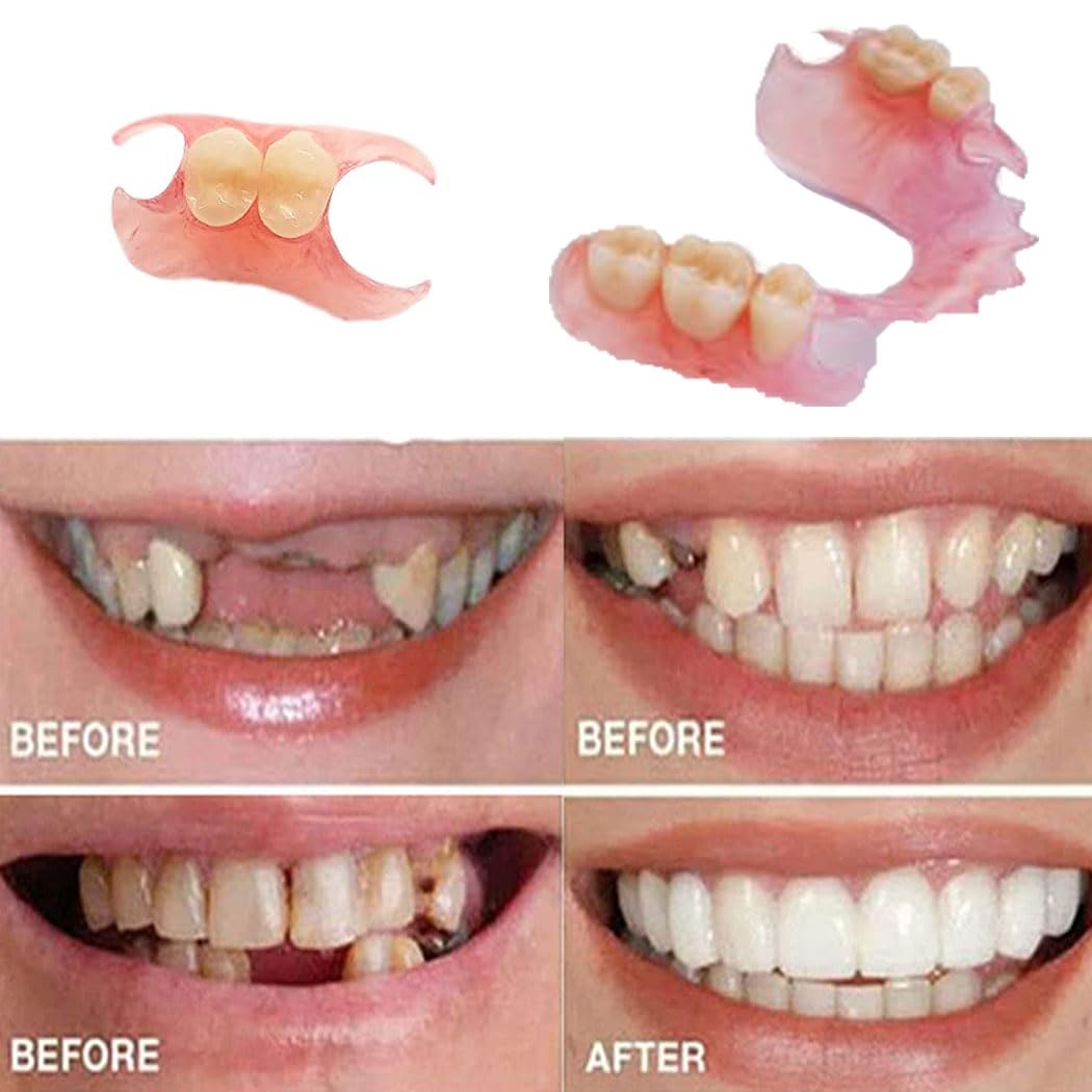 Do It Yourself Fake Tooth Repair Kits or Making Temporary Partial or Full Dentures,Tooth Fixing Kit for regaining Condident Smile