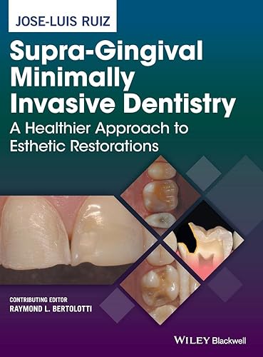 Supra-Gingival Minimally Invasive Dentistry: A Healthier Approach to Esthetic Restorations