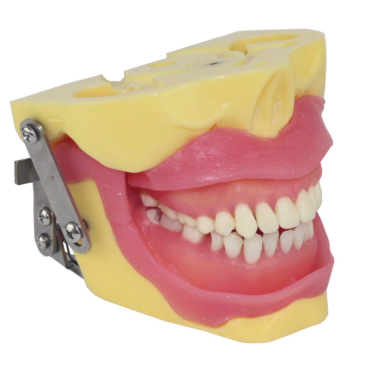 Modèle D'éducation - Modèle Dentaire Dentaire - Tiration De Chirurgie Buccale Anesthésie Opération Extraction Modèle De Démonstration - pour Aider À La Formation Médicale