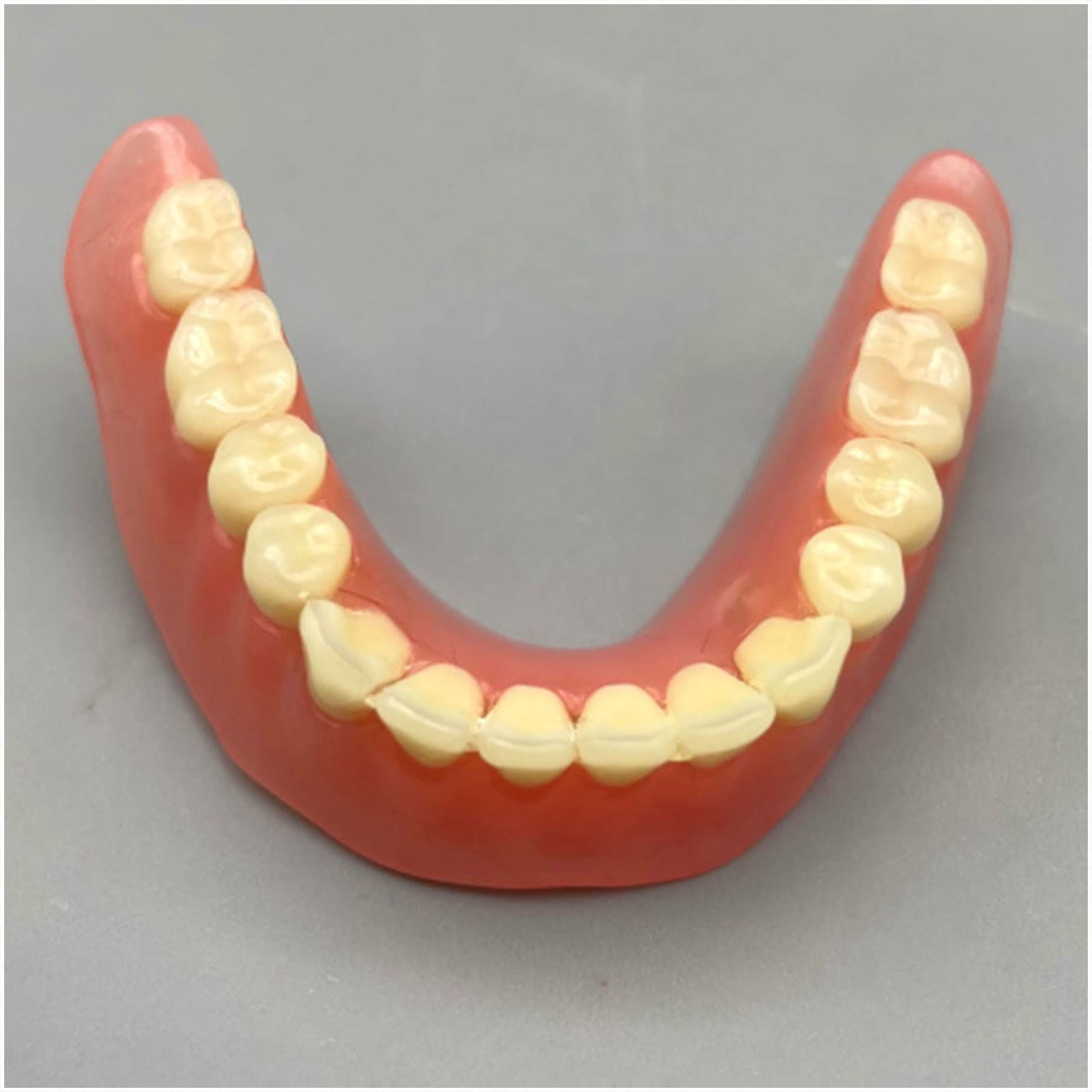 Zahnimplantat Modell - Overdenture 4 Implantate Modell - Transparentes Demo Dental Zahnmodell für Studie Erwachsene Standard Lehrmodell (Untere Zähne)