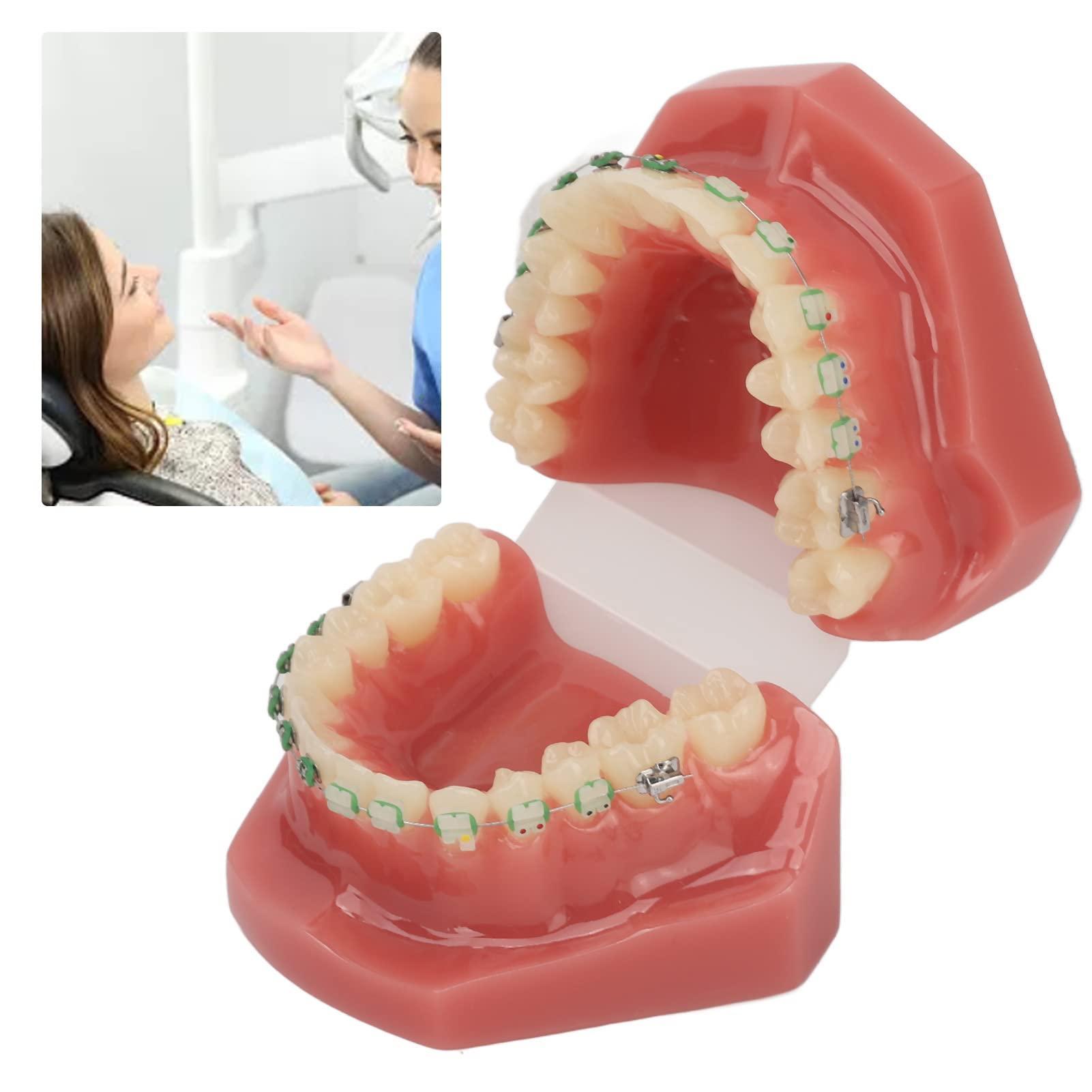 Modelo de Ortodoncia Profesional con Brackets Cerámicos y Metálicos para Enseñanza Odontológica