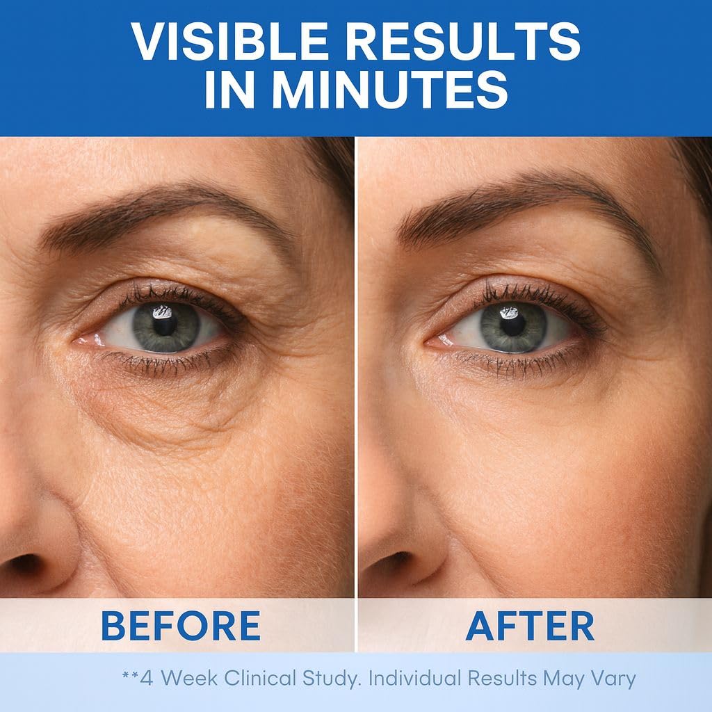 Instant Under Eye Lift Serum – Fast-Acting Firming Formula to Reduce Eye Bags, Wrinkles, Puffiness & Dark Circles | Advanced Polysaccharide Technology for Mature Skin – 20 mL (Fragrance Free)