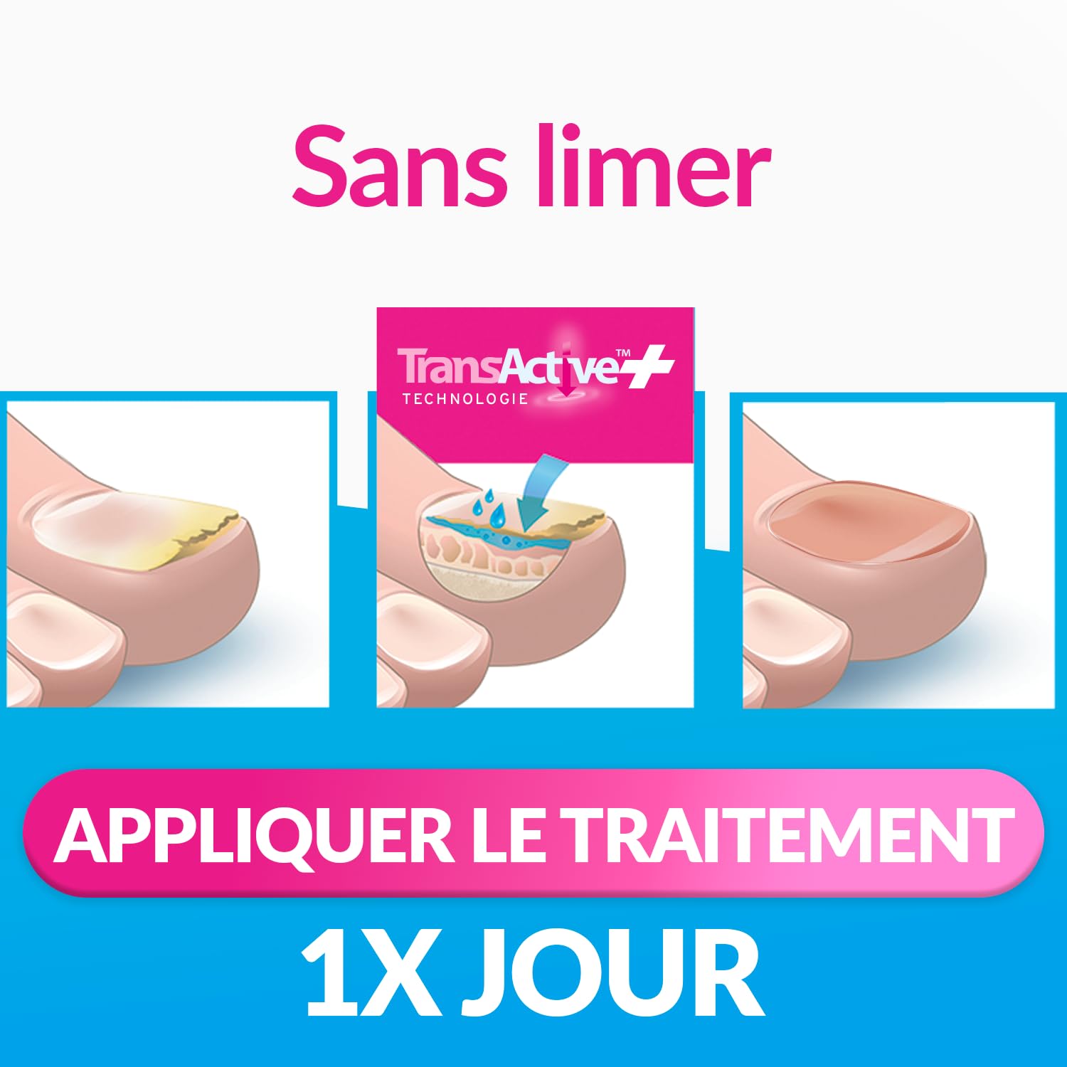 EXCILOR - Forte Color - Trattamento della micosi dell'unghia - Tratta e copre - Trattamento 30 ml + Smalto cosmetico per unghie da 8 ml - Clinicamente provato* - Nude