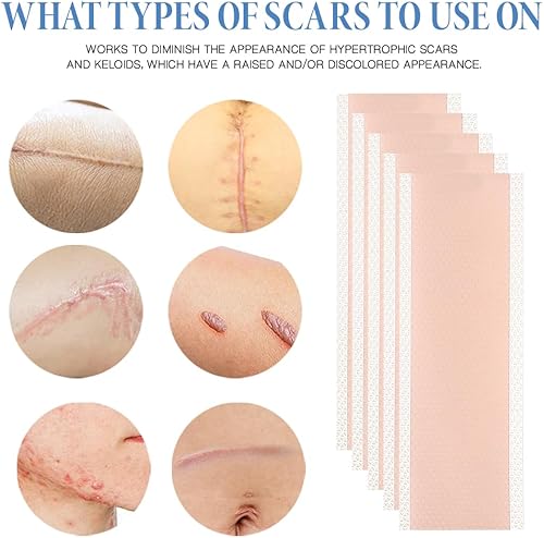 Miniatura 6 de Hojas de silicona para cicatrices, 5 unidades, cinta de silicona para cicatrices de 30 pulgadas, tiras de eliminación de cicatrices sin dolor,