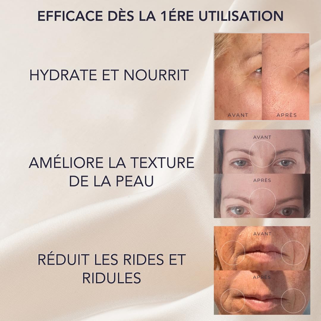 Kósmopellis Patch Anti-Âge Microneedling avec Acide Hyaluronique Réticulé et Peptide AHP-8 pour Traitement des Rides du Visage (8)