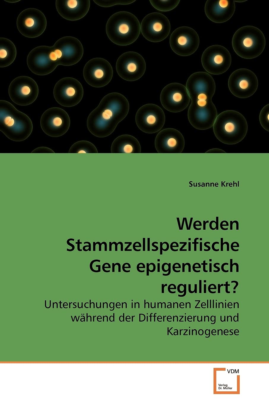 Werden Stammzellspezifische Gene epigenetisch reguliert?: Untersuchungen in humanen Zelllinien während der Differenzierung und Karzinogenese