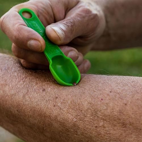 Miniatura 7 de TickCheck Cuchara removedor de garrapatas, paquete de 3 herramientas ligeras para quitar garrapatas con tarjeta de identificación de garrapatas y