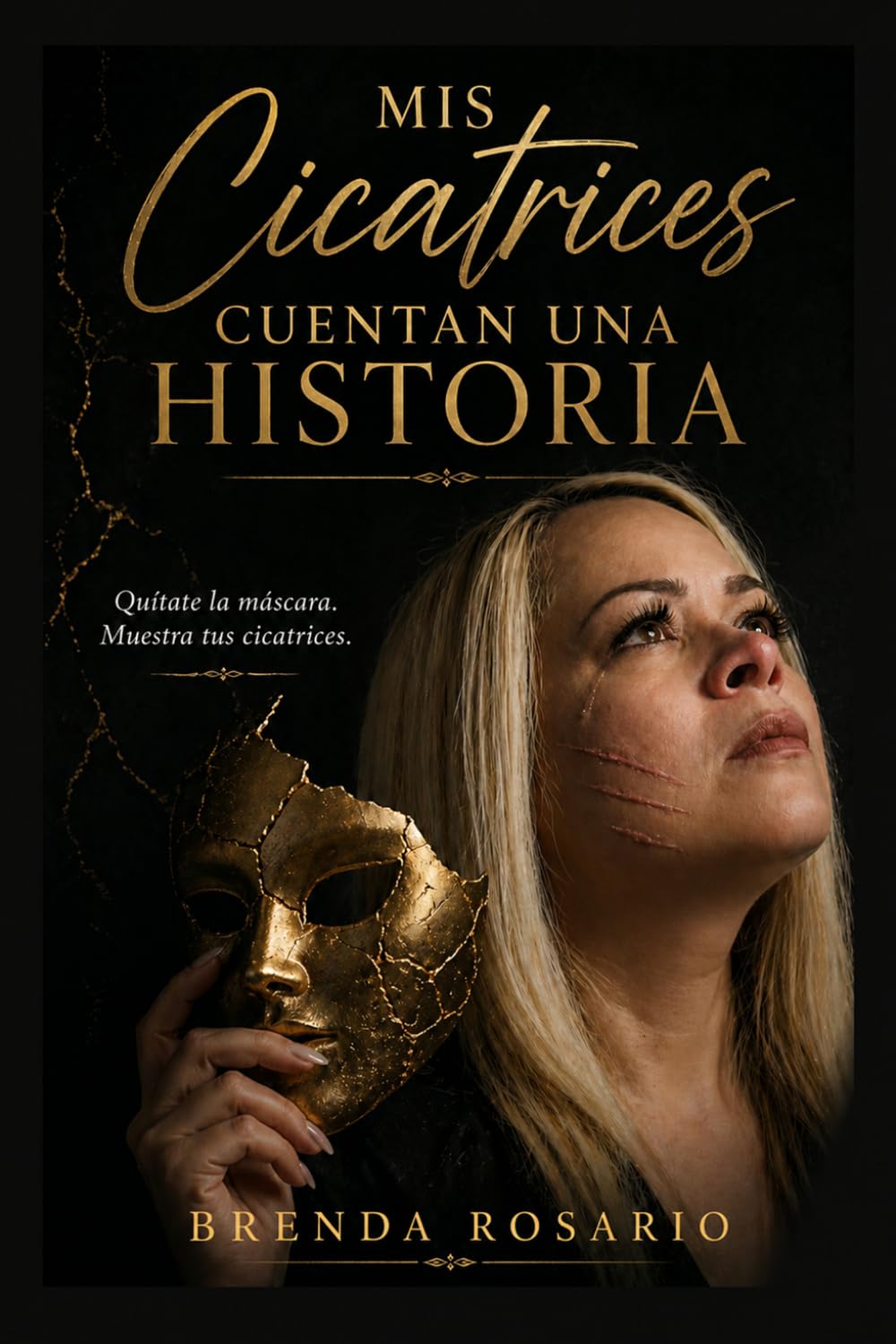 Mis Cicatrices Cuentan una Historia: Quítate la máscara. Muestra tus cicatrices
