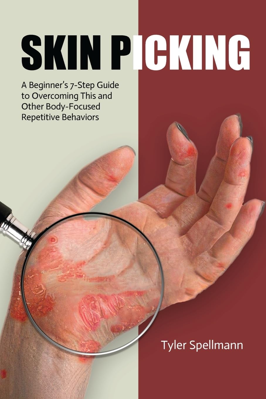 Skin Picking: A Beginner's 7-Step Guide to Overcoming This and Other Body-Focused Repetitive Behaviors