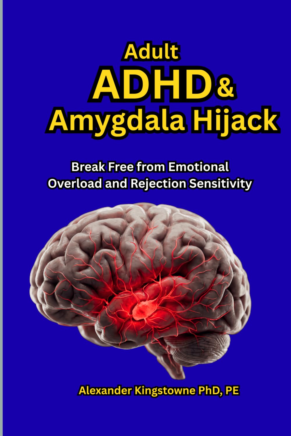 Adult ADHD & Amygdala Hijack: A Somatic Workbook for Navigating Rejection Sensitive Dysphoria, Healing Internalized Shame, and Recovering from Neurological Overload Meltdowns