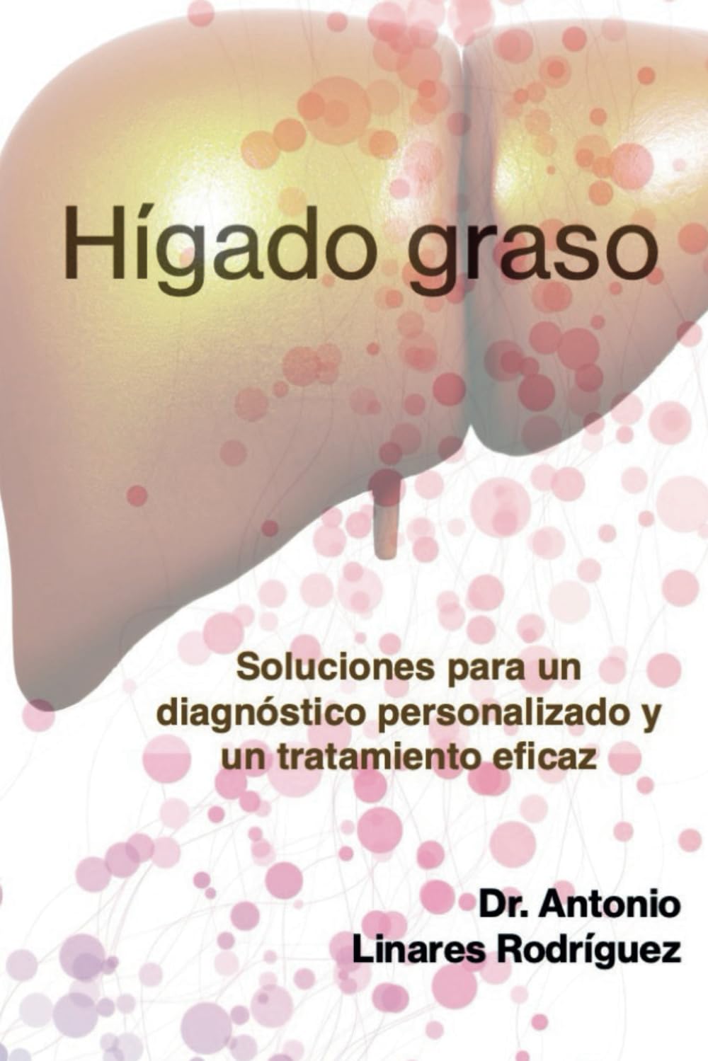 Hígado graso: Soluciones para un diagnóstico personalizado y un tratamiento eficaz