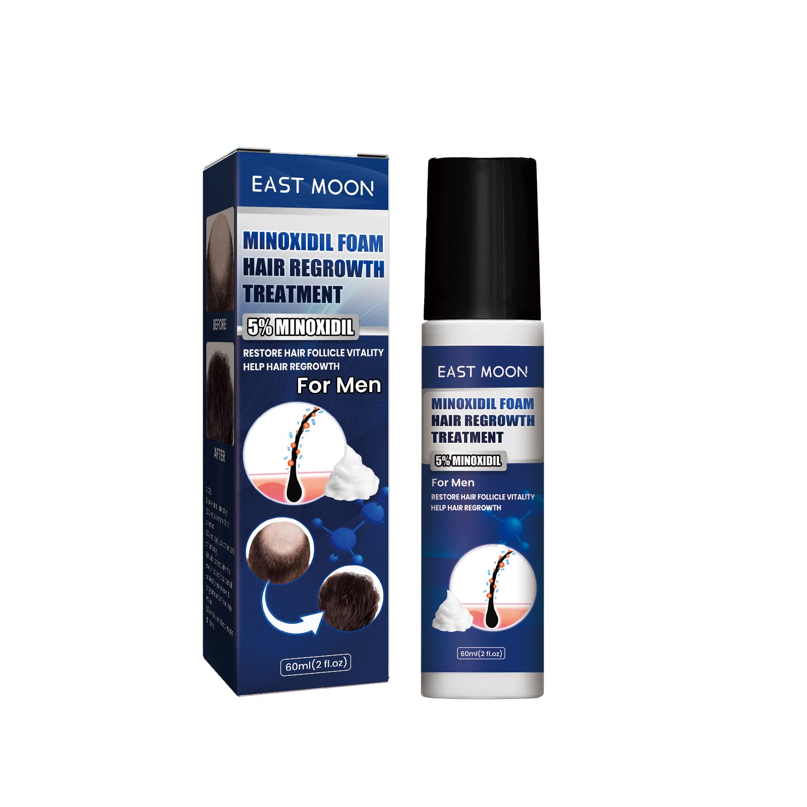 Buy 60ml Minoxidil Foam 5 Extra Strength Hair Regrowth Anti Hair Loss