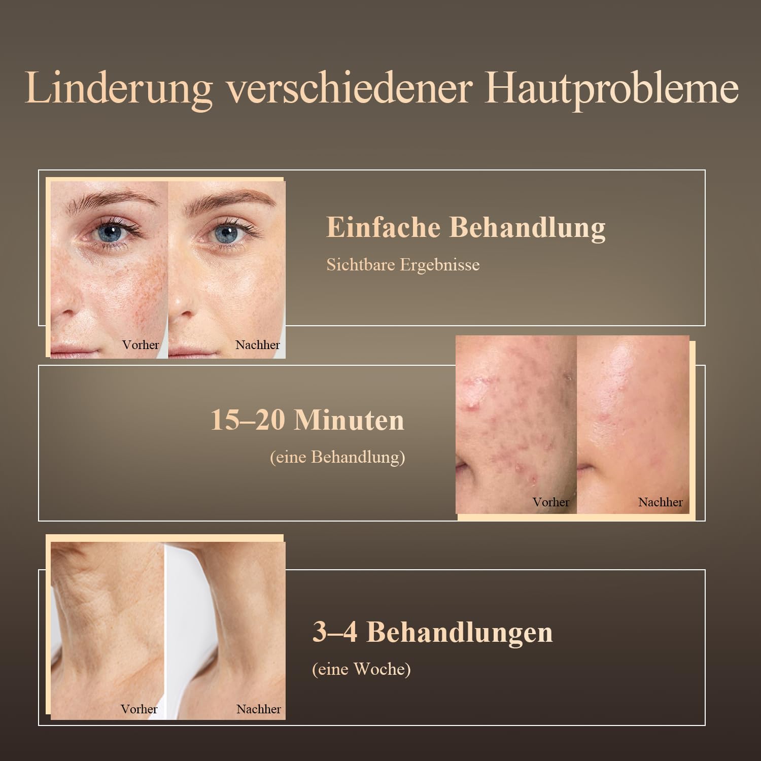 MEGELIN Led Rotlichttherapie Gesicht & Hals Maske, 7 Farben Led Lichttherapie Gesichtsmaske, Infrarot-Rotlicht-Therapie-Maske, Infrarot-Licht-Hautverjüngung (Weiß)