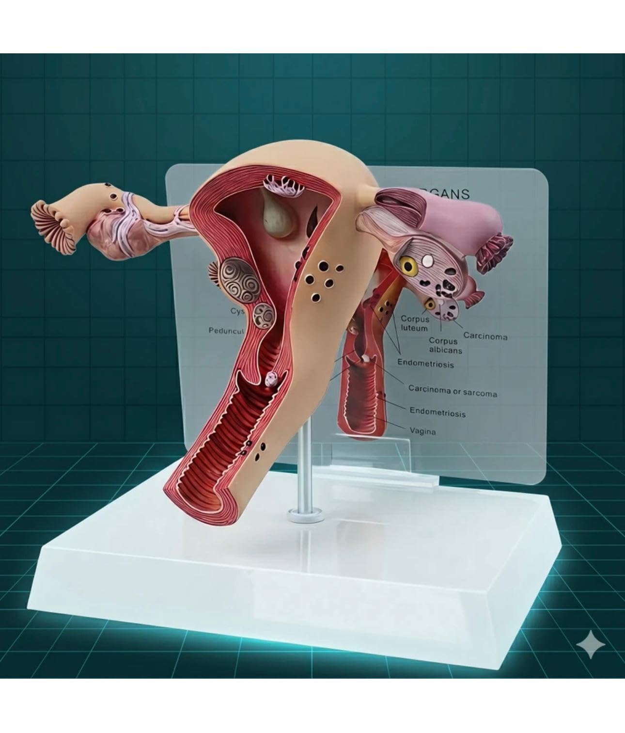 Uterus And Ovary Model Female Reproductive Organ Model Human Anatomy Replica Showing Teaching Anatomical Gynecology Doctor Patient-image-11