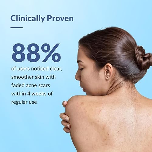 Miniatura 6 de Fixderma Salyzap Gel de baño para acné, gel de baño no espumoso | Exfoliante| Acné en la espalda, brazos, glúteos y otras partes afectadas del