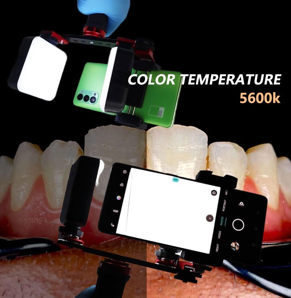 Kit de fotografía dental con luz LED para cámara de teléfono móvil, luz de relleno, flash dental brillante para odontología, clínica doméstica, hospital y estudio.(MKT-017)