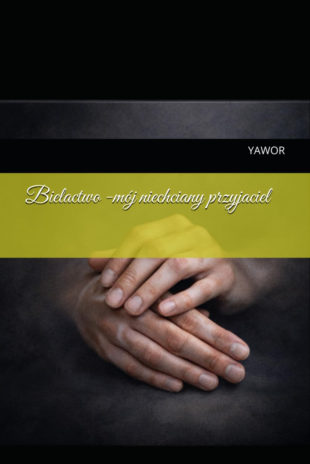 Bielactwo -mój niechciany przyjaciel