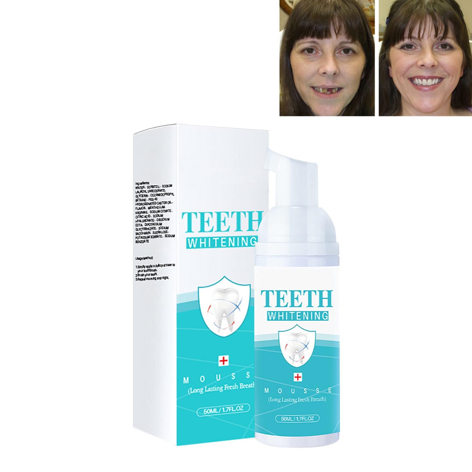Buy 2023 Teeth Mouthwash,Calculus Removal,Teeth Whitening,Healing Mouth