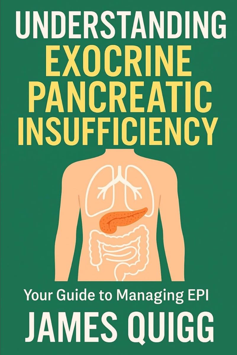 EPI management guide available on Amazon