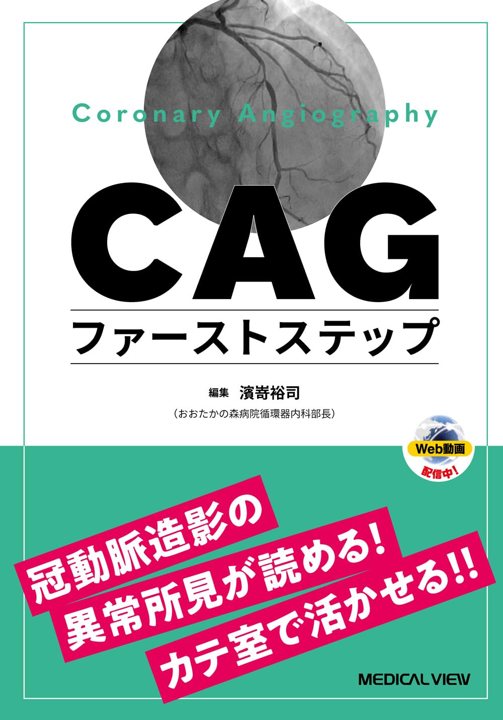 これから始めるPCI・CAG メジカルビュー社｜循環器内科｜これから始める心臓カテーテル検査
