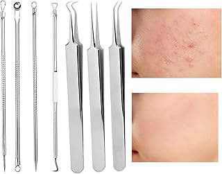 Kit extractor de espinillas de 7 piezas, kit ...