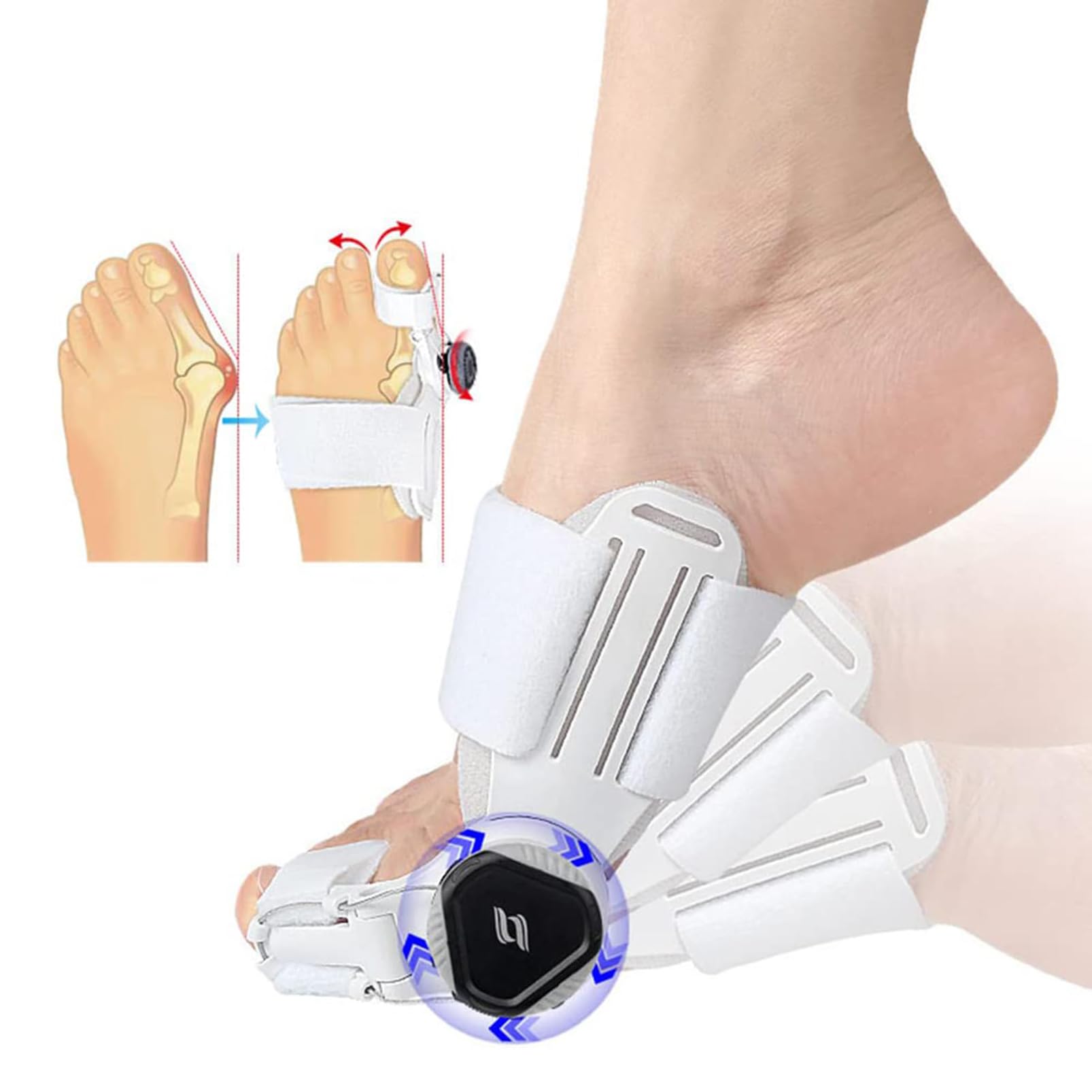 Correzione Alluce Valgo, Correttore per Alluce Valgo per Donne/Uomini, Stecca Notturna Regolabile per Alluce Valgo, Alleviare Dolore e Raddrizzare Dita Piedi