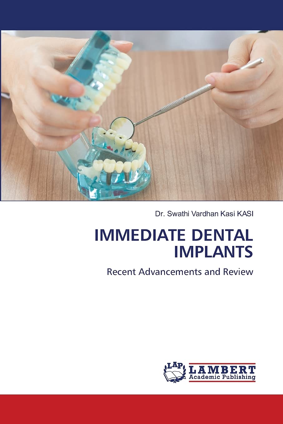 IMMEDIATE DENTAL IMPLANTS: Recent Advancements and Review Paperback – 28 Mar. 2021