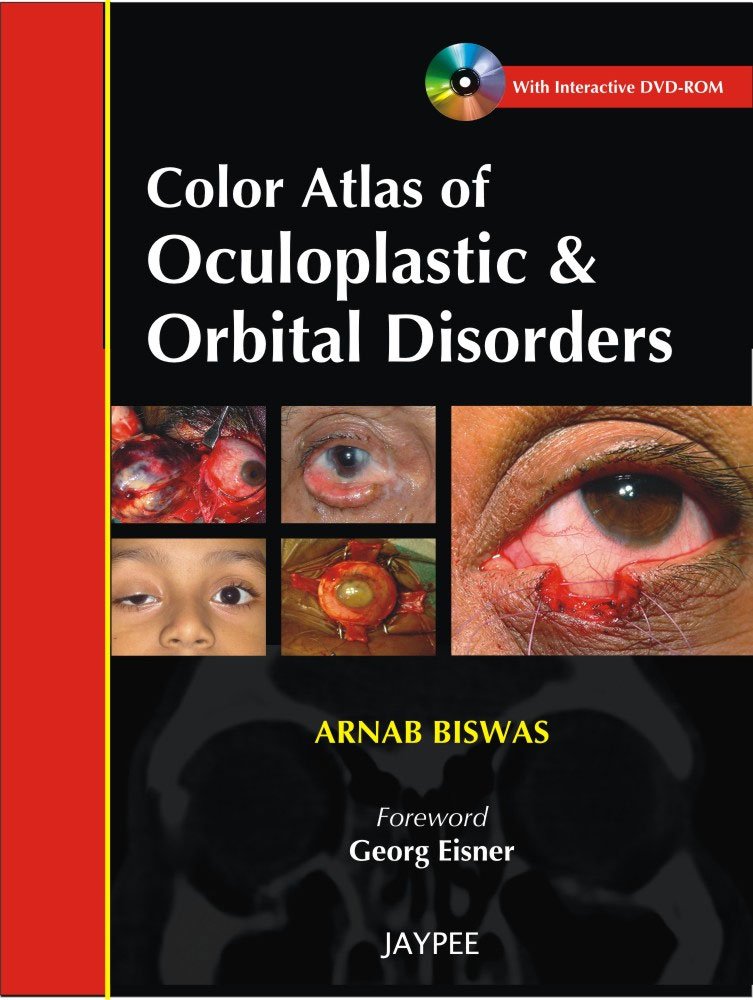 【美品】Atlas of Oculoplastic and Orbital Atlas of Oculoplastic and Orbital Surgery - 1st Edition