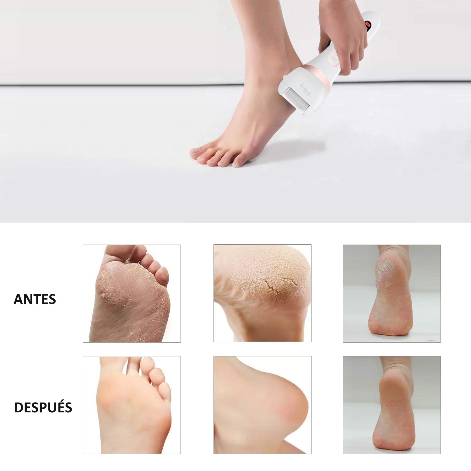 Lima Electrica Pedicura Profesional Recargable Wolady IPX7 Impermeable Eliminar Callos Pies Durezas Cuidado Lima Blanca de Metal, 3 Recambios 5 Niveles Bateria 1200MAH 2 Velocidades