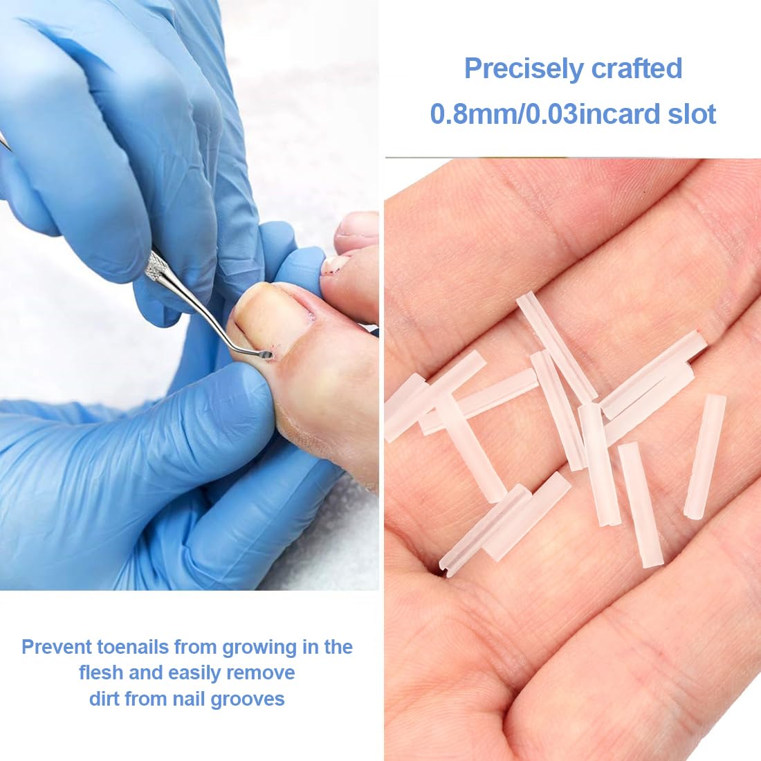 Set correttore per unghie incarnite, 50 pezzi Strisce raddrizzanti per unghie incarnite senza dolore con sollevatore per unghie, adesivi per unghie per unghie incarnite facili da usare
