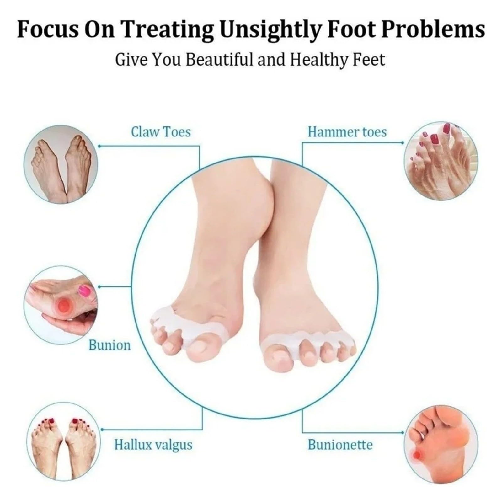 Separador de dedos de silicona, corrector de martillo, 1 par, gel de yoga, enderezador, cuidado de los pies