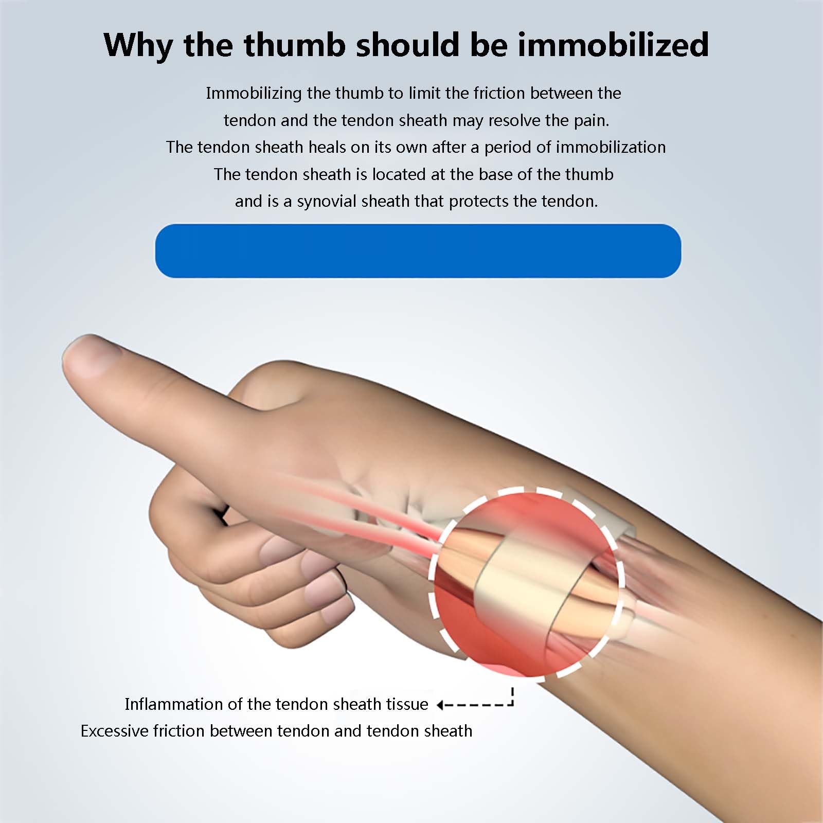 HAILM Ferula Pulgar con Férulas Metal, Muñequera Transpirable Túnel Carpiano, Adapta Hombres y Mujeres, Ayuda Aliviar Dolor Articular, Artritis, Tendinitis, Fracturas Muñeca/Esguince,Right Hand,S