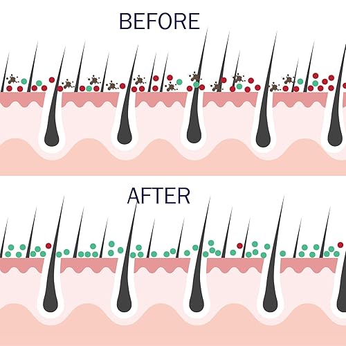 Miniatura 3 de Probiotic Action Claridad en equilibrio. Las bacterias respaldadas por la ciencia combaten el riesgo de acné, rosácea y eccema