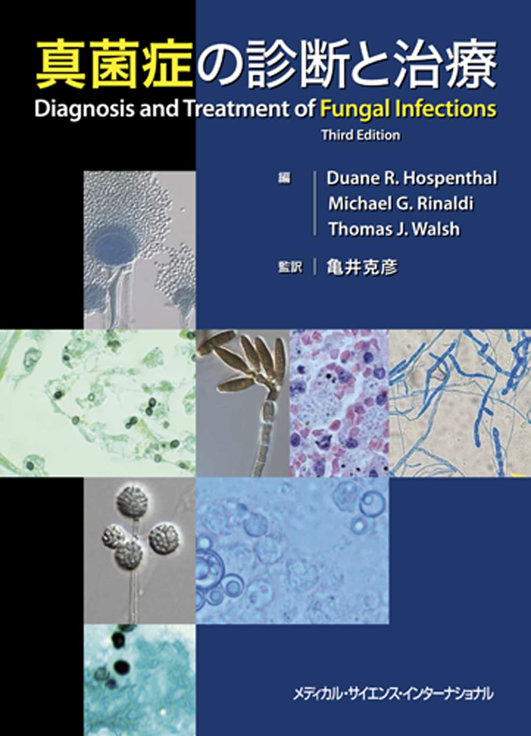 真菌症の診断と治療 | 亀井克彦 |本 | 通販 | Amazon
