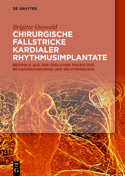 Chirurgische Fallstricke kardialer Rhythmusimplantate: Beispiele aus der täglichen Praxis der Revisionschirurgie und Rechtsmedizin