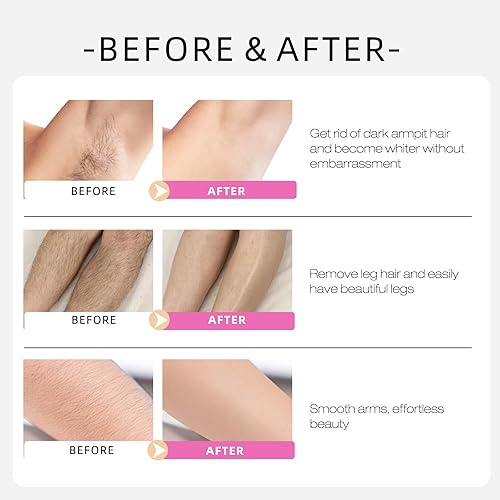 Miniatura 7 de Aceite Cyperus Rotundus, suaviza la piel - Cyperus Rotundus Skin Serum, aceite corporal hidratante natural orgánico calmante que reduce el vello