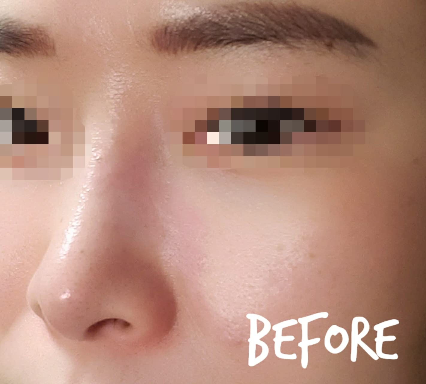 Amazon.co.jp Hellocell (ハローセル)ビタミンKドクタープチクリーム 15ml Vitamin K Doctor Petit Cream for Bruises