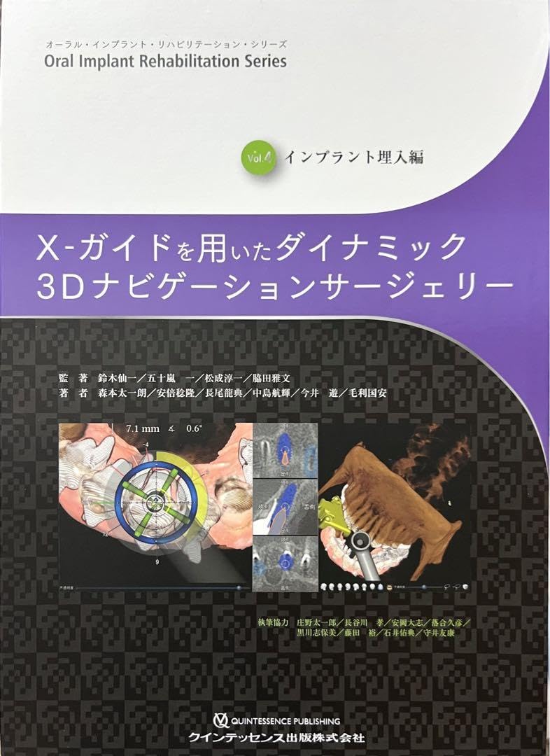 X-ガイドを用いたダイナミック3Dナビゲーションサージェリー X-ガイドを用いたダイナミック3Dナビゲーションサージェリー