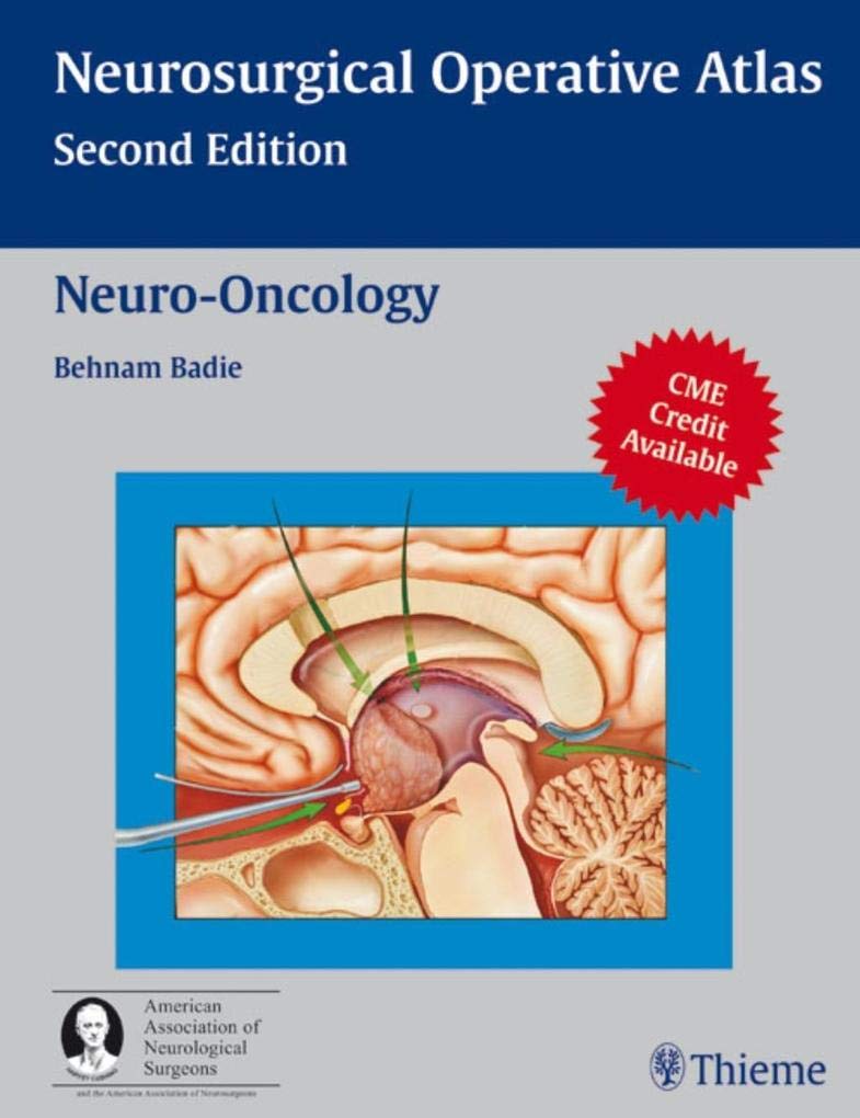 Neuro-Oncology: Neurosurgical Operative Atlas