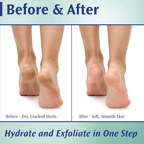 Miniatura 2 de Pedifix Podiatrists' Choice - Crema para pies extra fuerte con control de callos urea al 20%, 4 onzas (3.99 oz), tratamiento profesional para pies