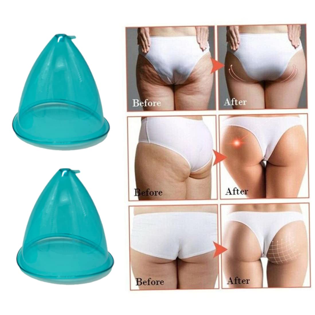 2 pièces d'aspiration sous vide pour les fesses, ventouses de Massage sous vide, dispositif de levage des hanches, tasse Massage